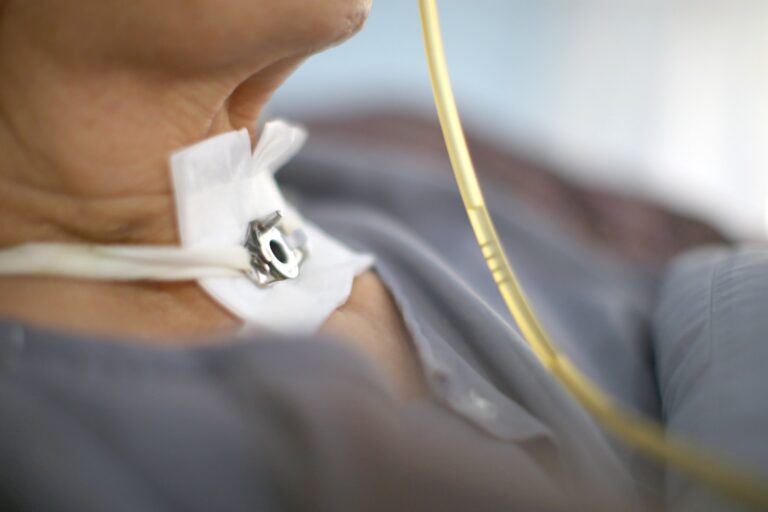 ENTENDENDO A TRAQUEOSTOMIA E O DESMAME VENTILATÓRIO